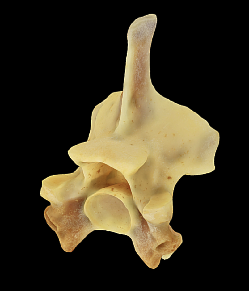 Cervical vertebra of a Reticulated Python
